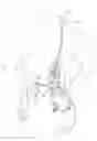 Fig. 01 - Detecting needle entry into a port of an infusion device
