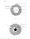 Fig. 03 - Method and Apparatus for Ophthalmic Medication Delivery and Ocular Wound Recovery