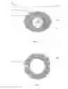 Fig. 04 - Method and Apparatus for Ophthalmic Medication Delivery and Ocular Wound Recovery