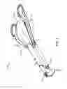 Fig. 02 - Replaceable tip suturing devices, system, and methods for use with differing needles