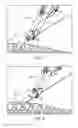 Fig. 07 - Replaceable tip suturing devices, system, and methods for use with differing needles