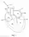 Fig. 02 - DELIVERY DEVICES AND METHODS FOR HEART VALVE REPAIR