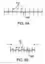 Fig. 11 - DELIVERY DEVICES AND METHODS FOR HEART VALVE REPAIR