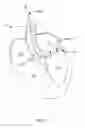 Fig. 21 - DELIVERY DEVICES AND METHODS FOR HEART VALVE REPAIR