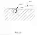 Fig. 33 - DELIVERY DEVICES AND METHODS FOR HEART VALVE REPAIR