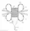Fig. 01 - Luminal structure anchoring devices and methods