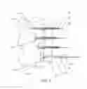 Fig. 07 - Luminal structure anchoring devices and methods