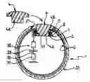Fig. 01 - Pouch-Equipped Intragastric Balloon