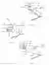 Fig. 04 - System and method for percutaneous delivery of electrical stimulation to a target body tissue
