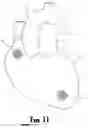 Fig. 08 - CARDIAC STIMULATION APPARATUS