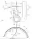 Fig. 01 - Minimally invasive systems for locating an optimal location for deep brain stimulation