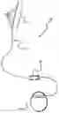 Fig. 01 - Lead anchor for implantable stimulation devices
