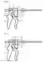 Fig. 26 - Intracranial stent and method of use