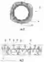 Fig. 03 - Stent removal and repositioning device and associated method