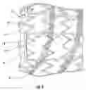 Fig. 05 - Stent removal and repositioning device and associated method