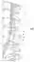 Fig. 06 - Stent removal and repositioning device and associated method