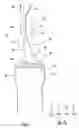 Fig. 07 - Stent removal and repositioning device and associated method
