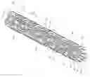 Fig. 01 - STENT HAVING RADIALLY EXPANDABLE MAIN BODY
