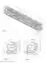 Fig. 02 - STENT HAVING RADIALLY EXPANDABLE MAIN BODY