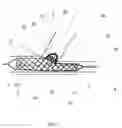 Fig. 02 - Bifurcation stent and balloon assemblies