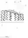 Fig. 03 - Bifurcation stent and balloon assemblies