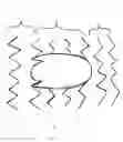 Fig. 06 - Bifurcation stent and balloon assemblies