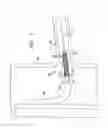 Fig. 02 - Device and Methods for Treatment of Vascular Bifurcations