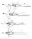 Fig. 04 - Lateral spinous process spacer