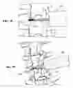 Fig. 14 - Lateral spinous process spacer