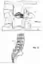 Fig. 17 - Lateral spinous process spacer