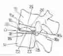 Fig. 01 - Intervertebral disc prosthesis