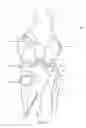 Fig. 02 - Knee Joint Prosthesis