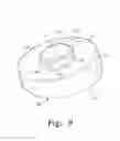 Fig. 10 - Mobile bearing assembly having a non-planar interface