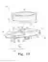 Fig. 14 - Mobile bearing assembly having a non-planar interface