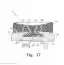 Fig. 18 - Mobile bearing assembly having a non-planar interface