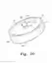 Fig. 21 - Mobile bearing assembly having a non-planar interface