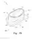 Fig. 36 - Mobile bearing assembly having a non-planar interface
