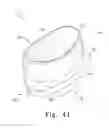 Fig. 38 - Mobile bearing assembly having a non-planar interface