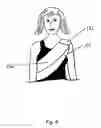 Fig. 06 - Nursing cover