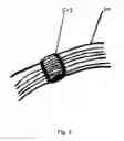Fig. 07 - Nursing cover