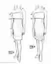 Fig. 06 - Apparel with Built-in Undergarment