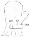 Fig. 01 - Child's Mitten