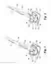 Fig. 04 - Cleaning tool