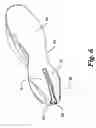 Fig. 06 - Cleaning tool