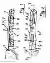 Fig. 02 - Handle or gripping implement for a cooking vessel