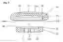 Fig. 03 - Separable ornamented button