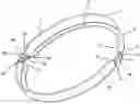 Fig. 01 - Clamp band for spring brakes