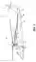 Fig. 04 - Infrared suppression system