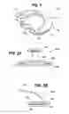 Fig. 02 - Device for opening and sealing a beverage can lid