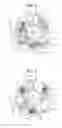 Fig. 04 - Valve Timing Adjusting Device